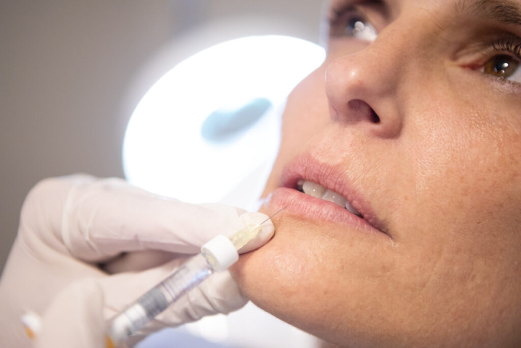 40s woman getting lip filler in Joplin