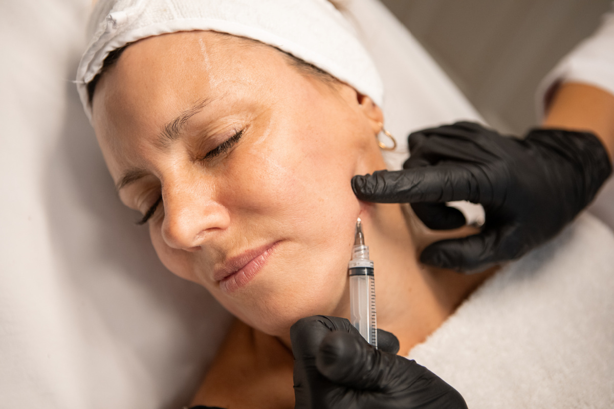 Filler treatment for mature skin